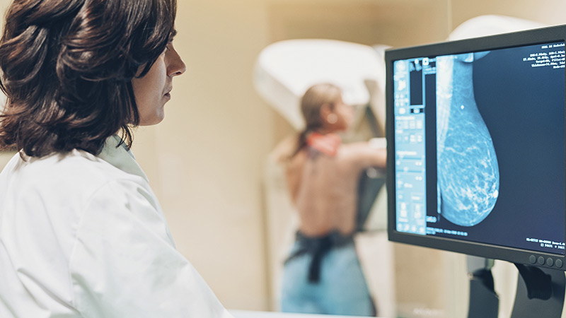 Médica analisando nódulos na mamografia de paciente