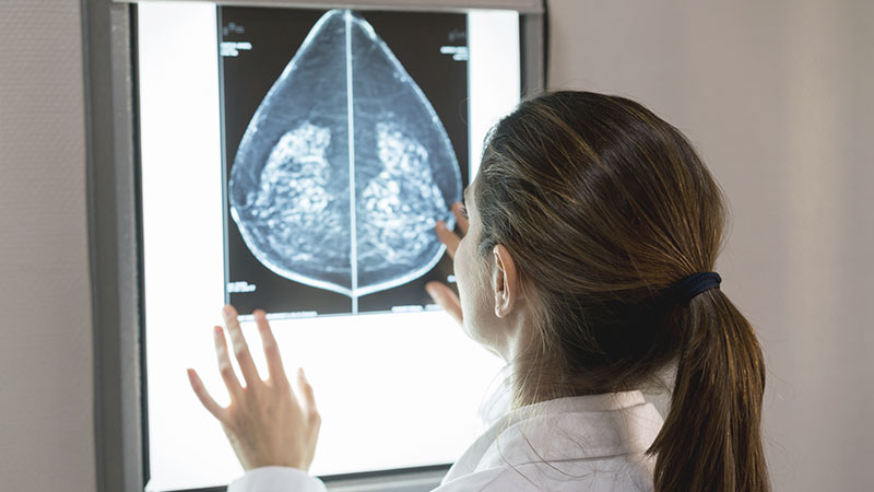 Médica verificando na mamografia a calcificação