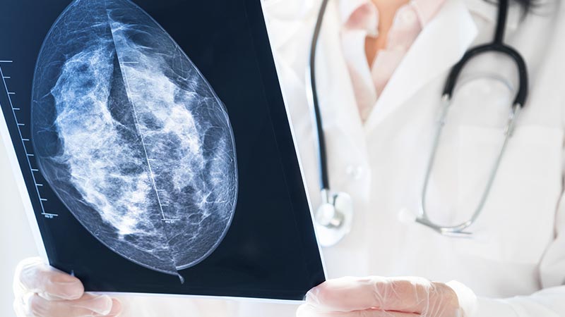 Médica que analisa resultados da mamografia no raio-x