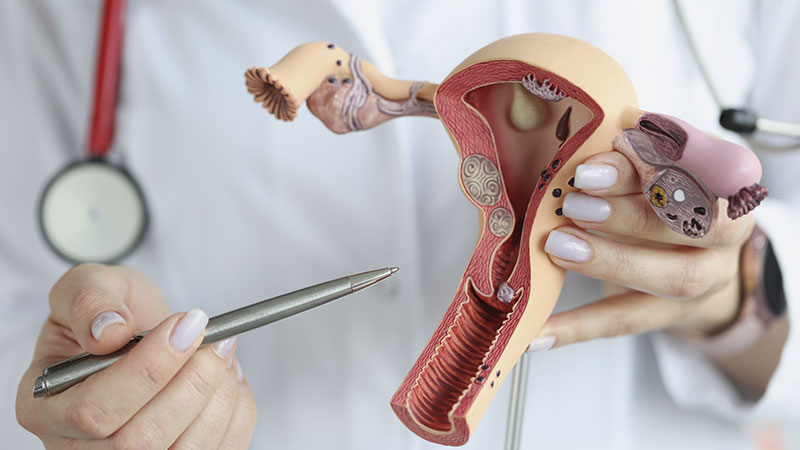 Imagem do médico demonstrando ovário