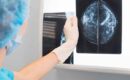 Profissional de saúde analisando carcinoma oculto de mamografia