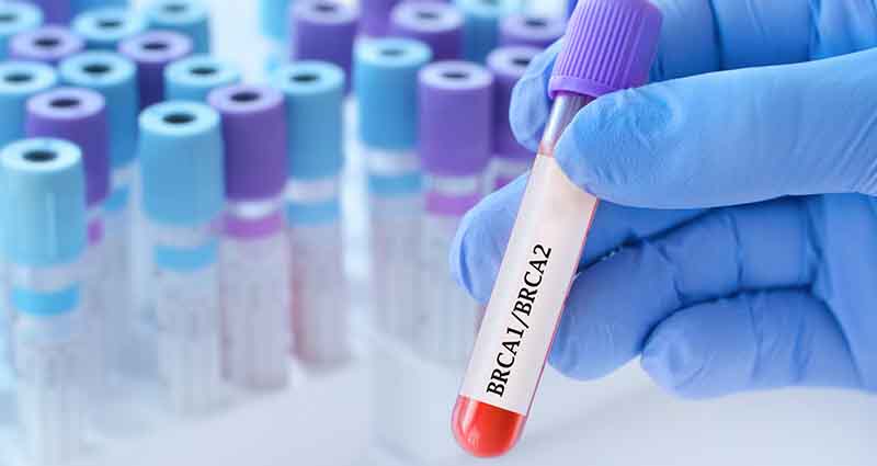 Foto de laboratório com amostras de brca1 e 2