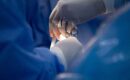 Cirurgia de mama usando a técnica em L