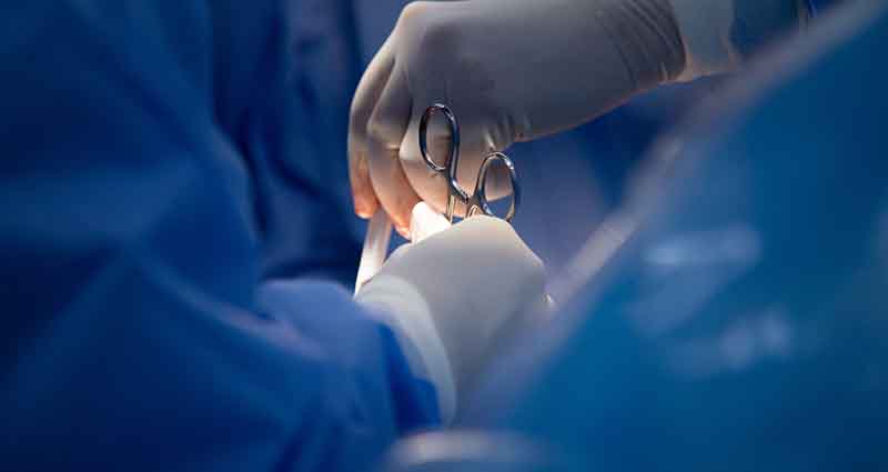 Cirurgia de mama usando a técnica em L