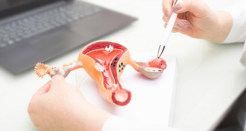 Médico explicando sobre os ovários