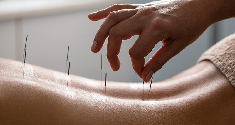 Tratamento de acupuntura