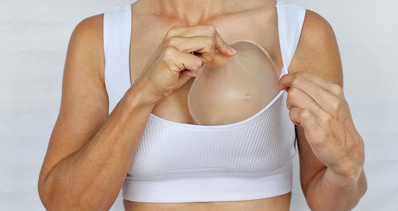 Uma mulher demonstra o processo de aumento de peito usando um implante de silicone